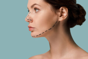 Chin Implant Procedure | Achieve a Defined Jawline with a Chin Implant