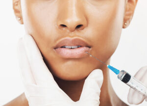 Lip Enhancement Procedure | Achieve Plump Lips with Expert Lip Enhancement