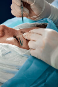 Rejuvenate Your Upper Eyelids with Expert Surgery