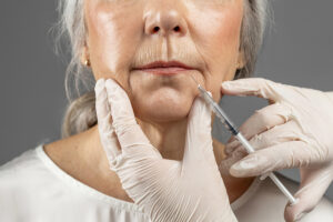 Wrinkle Filler Procedure | Get Smoother Skin with Wrinkle Fillers